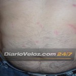 Caso Angeles : Las fotos exclusivas de las heridas del portero Jorge Mangeri.