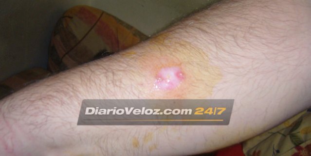 Caso Angeles : Las fotos exclusivas de las heridas del portero Jorge Mangeri.