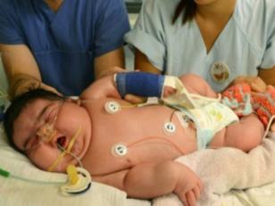 Este es el bebé mas grande del mundo que nació por parto natural