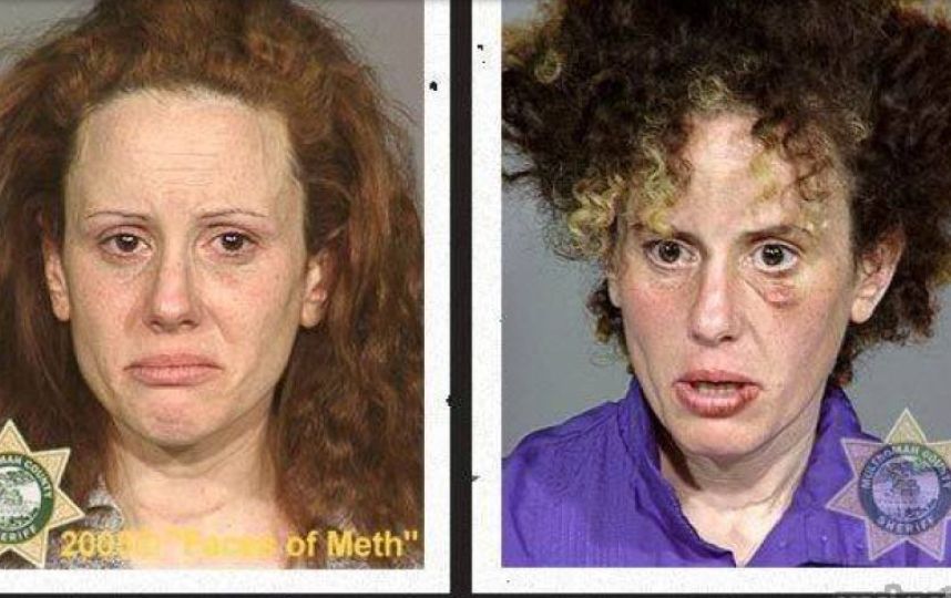 Drogas: Impresionante fotos del antes y el después