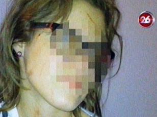 Un chica de 17 años fue atacada violentamente por ser linda
