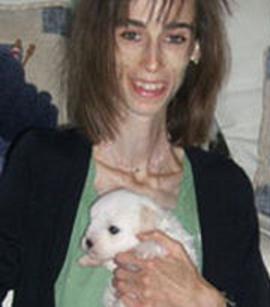 Murió la mujer con el peor caso de anorexia del mundo