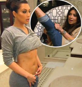 KIM KARADASHIAN TIENE PSORIASIS