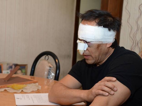 BRUTAL GOLPIZA DE UN PADRE A UN PROFESOR POR DESAPROBAR A UNA ALUMNA