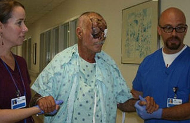 Así quedó la presa del caníbal yanqui. Foto