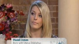 El extra�o caso de la mujer con 2 vaginas