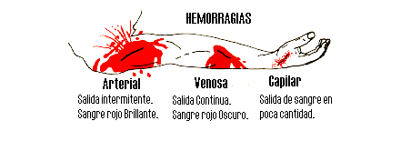 Que hacer ante una Hemorragia