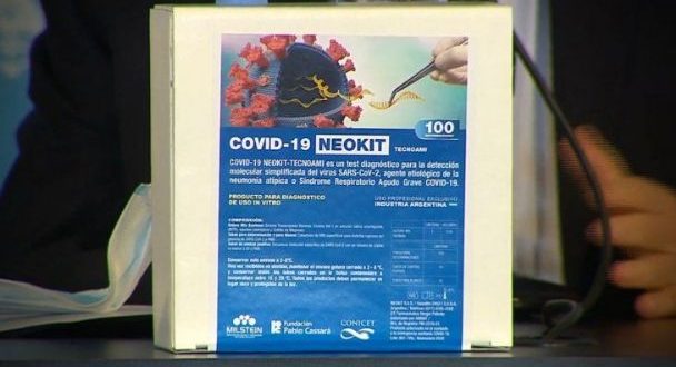 Científicos y científicas de nuestro país crearon el nuevo test de diagnóstico rápido "NEOKIT-COVID-19".