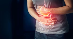 Qué es el síndrome del intestino irritable y cómo sentirte mejor si lo tienes