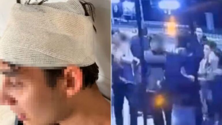 Joven denuncia ataque de rugbiers en Mendoza