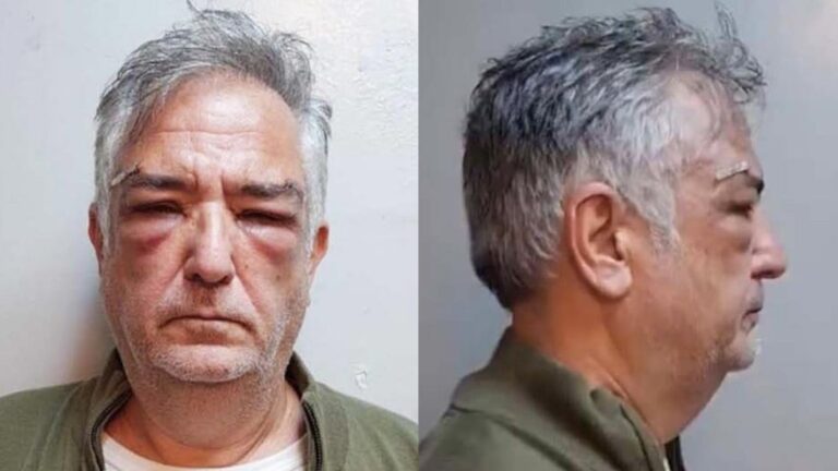 Detrás del Caso Calvete: Bailarinas, Propiedades y Explotación Sexual
