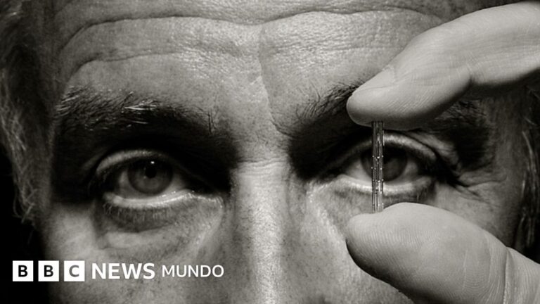 Julio Palmaz: El argentino que transformó la cardiología gracias a un hallazgo accidental