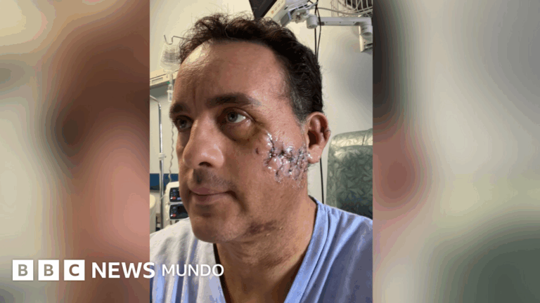 Sobrevive a un ataque de tiburón: el asombroso testimonio de un mexicano