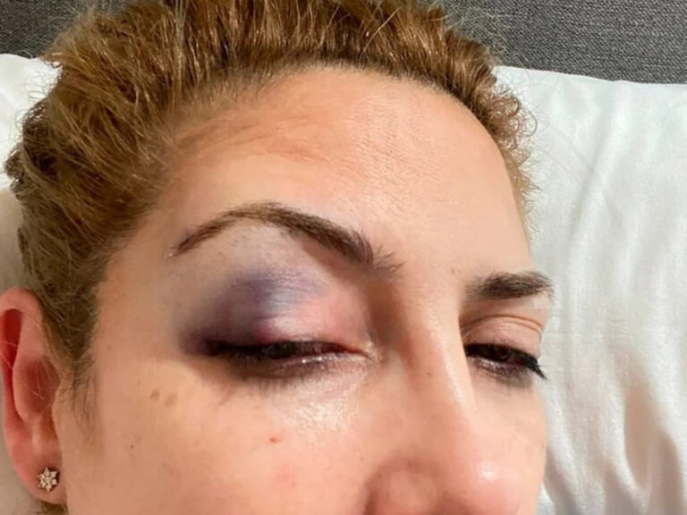 Fabiola Yañez Revela Detalles de la Violencia Denunciada a Alberto Fernández