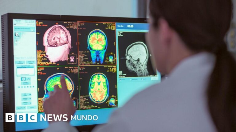 La adolescencia se extiende hasta los 32 años: Descubre las edades clave para el cerebro