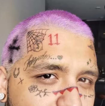 Christian Nodal en proceso de eliminación de tatuajes