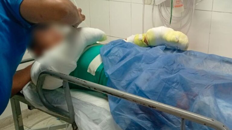 Un celular gamer explota al cargarse y deja a un adolescente con quemaduras en el 60% del cuerpo