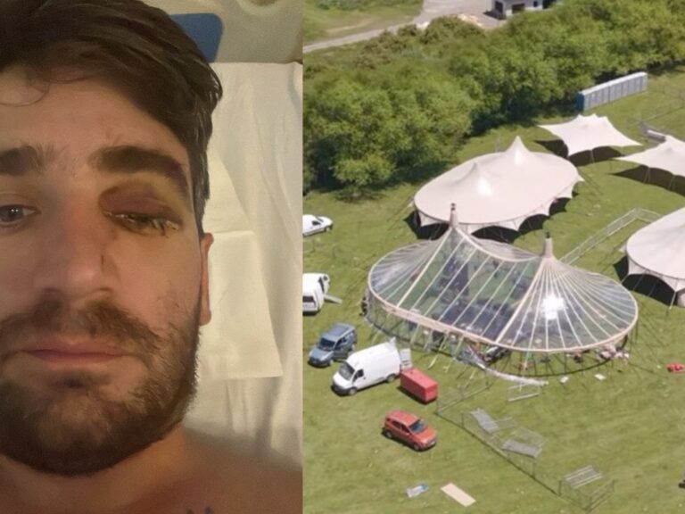 Celebró Año Nuevo en Patagonia y perdió un ojo por un petardo en una fiesta