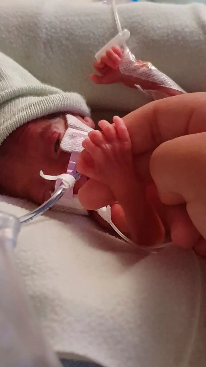 Emilia en la neonatal