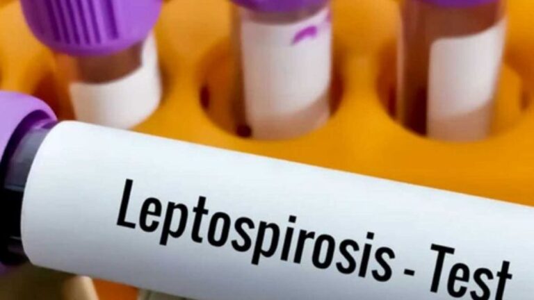 Córdoba: Hombre fallece por leptospirosis en Bell Ville