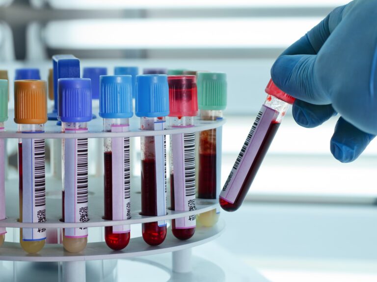 Nueva técnica de análisis de sangre promete detectar varios tipos de cáncer
